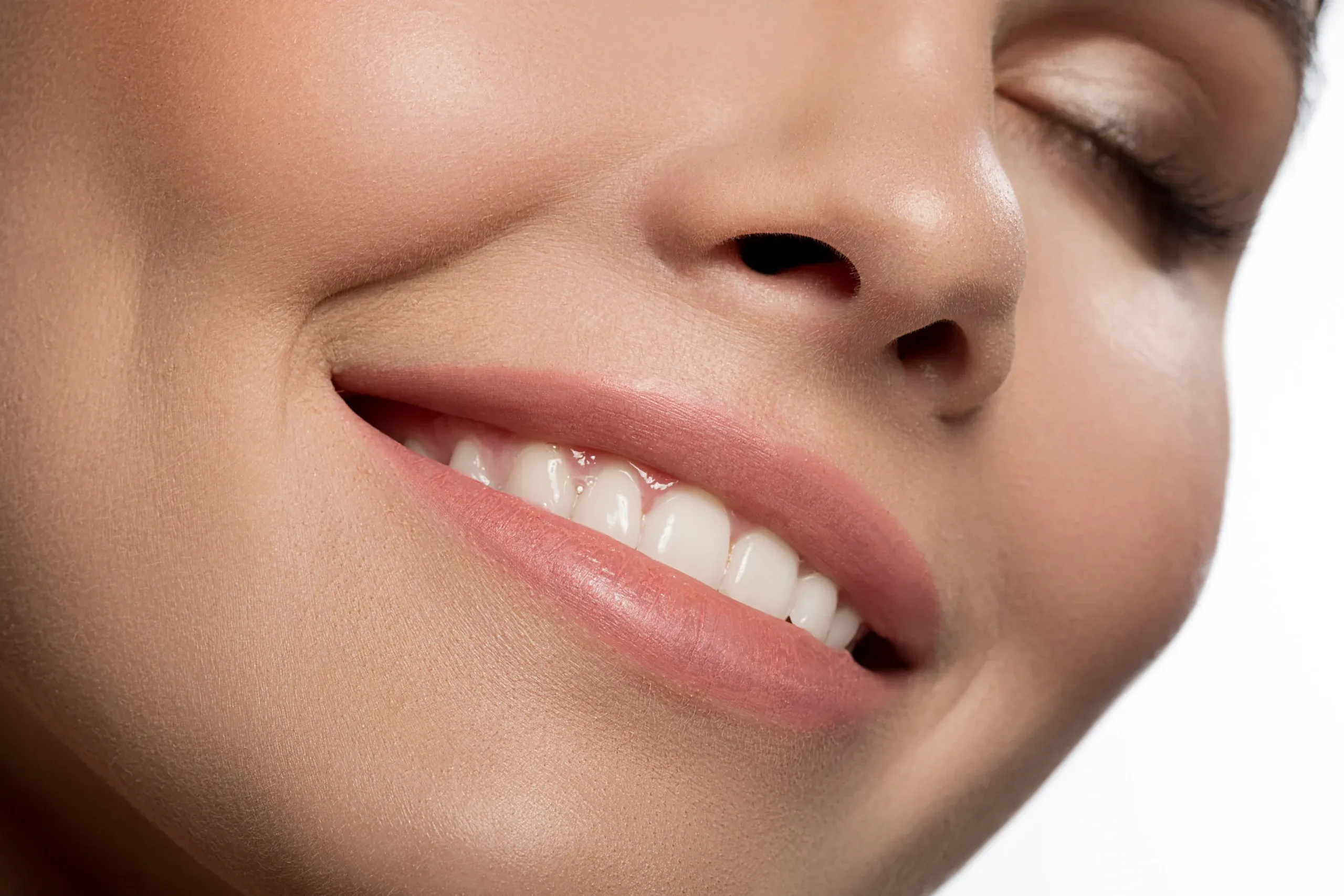 Close up of a woman's bright, even smile representing dental veneers results